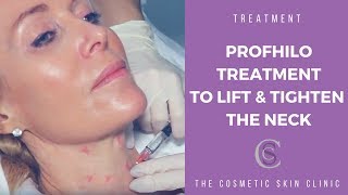 Profhilo Treatment To Lift And Tighten The Neck  The Cosmetic Skin Clinic [upl. by Hannibal]