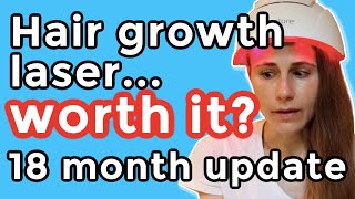 iRestore hair growth laser 18 month update Is it worth it Dr Dray [upl. by Ehcadroj]