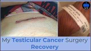 My Testicular Cancer Surgery Recovery [upl. by Kcirredal]