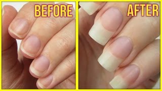 5 Ways to Grow Your Nails FAST [upl. by Dyson]