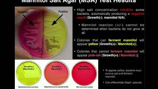 Mannitol Salt Agar MSA  Results amp Theory [upl. by Zosima]