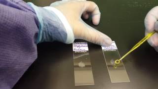 Microbiology the Catalase test [upl. by Anegue101]