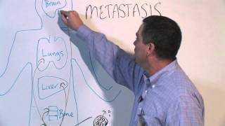 How to manage one sided testicular pain amp sagging  Dr Ravish I R [upl. by Iadrahc]