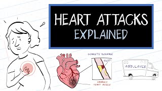 Signs and symptoms of a heart attack [upl. by Arded]