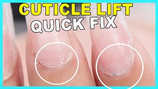 Fix Ugly Cuticles FAST⏱  No Nail Fill Required [upl. by Emoreg577]